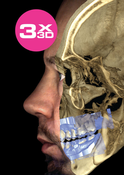 Planmeca Promax 3D Mid CBCT Imaging System