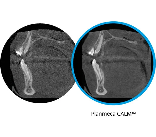 Planmeca Promax 3D Classic CBCT Imaging System