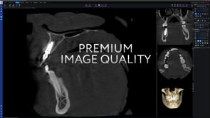 Planmeca Viso G5 CBCT Imaging Sytem