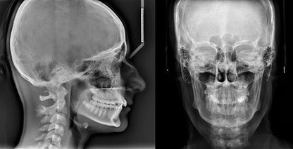 Planmeca Viso G7 CBCT Imaging System