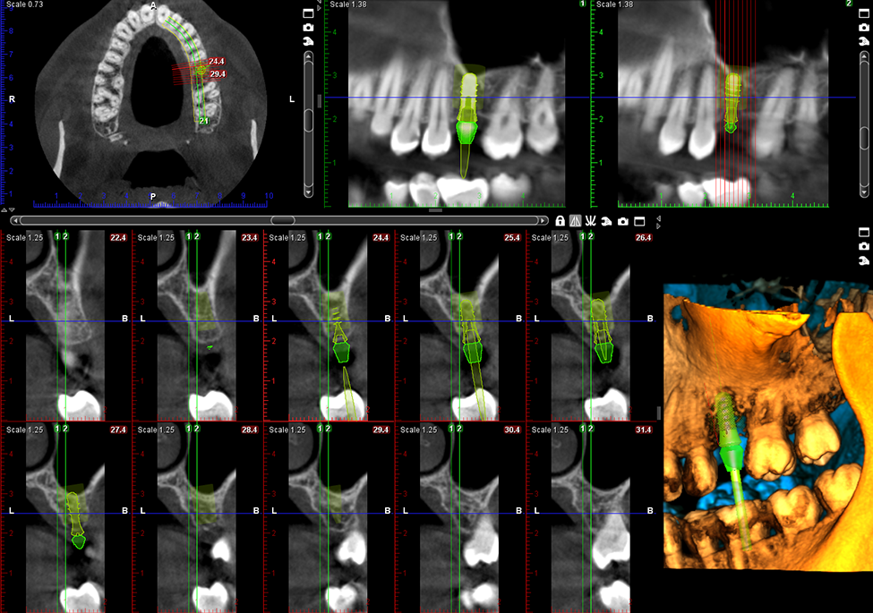 Planmeca Promax 3D Mid CBCT Imaging System